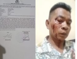 Jadi Korban Pengeroyokan 2 Oknum Guru Ngaji, Wartawan Lapor Polisi